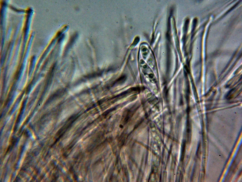 Calycina citrina 10 - Asco y paráfisis